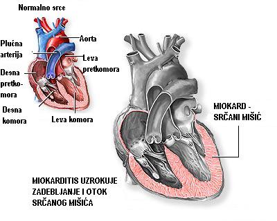 srce daje u leđa lijek za injekcije visokog krvnog tlaka